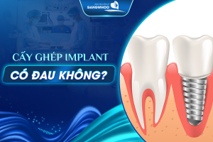 phương pháp trồng răng implant có đau không
