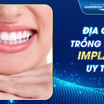 Địa chỉ trồng răng implant uy tín