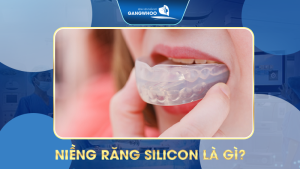 Niềng răng silicon là gì? Các loại niềng răng silicon phổ biến