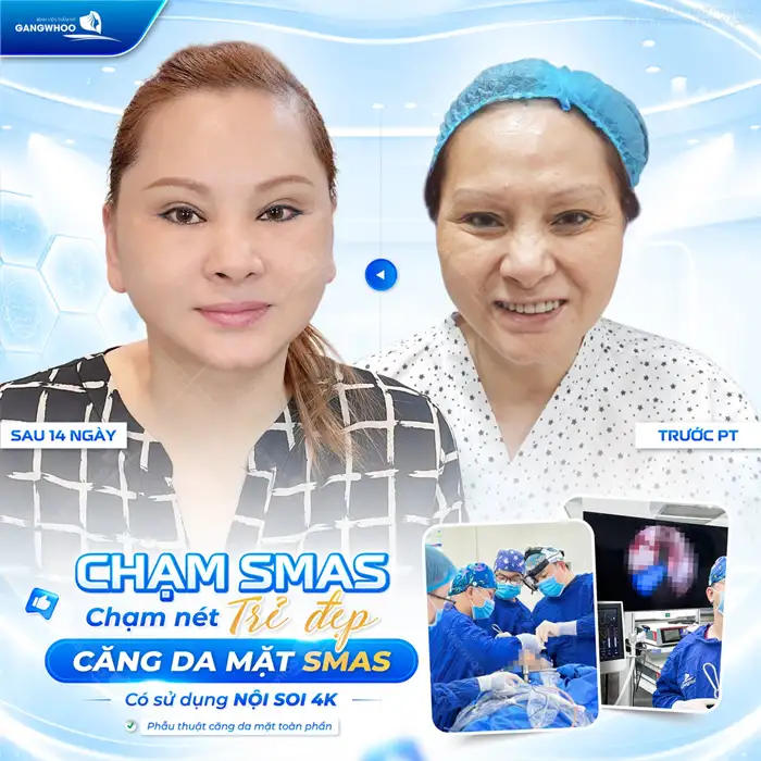Căng Da Mặt Bao Lâu Thì Lành? Cách Chăm Sóc Da Mặt Hồi Phục Nhanh Hơn