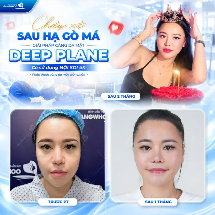 4 Tiêu Chí Để Lựa Chọn Địa Điểm Căng Da Mặt Ở Đâu tốt