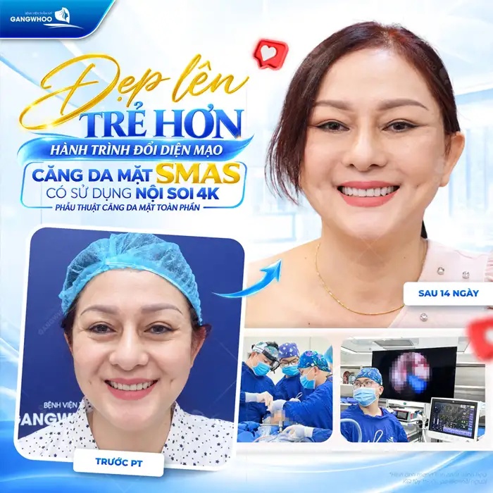 Những Phương Pháp Căng Da Mặt Nào Hiệu Quả – Hiện Nay?