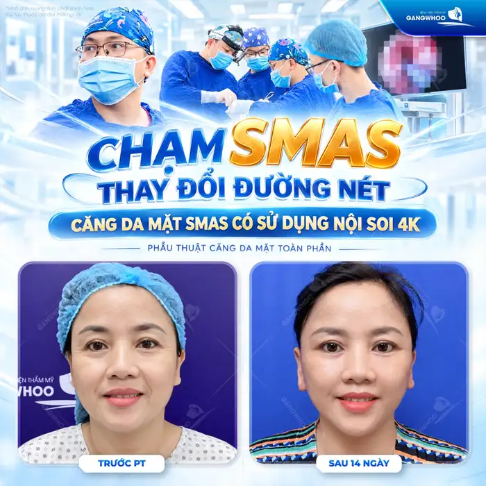Bao Nhiêu Tuổi Thì Nên Căng Da Mặt Là Đẹp -?