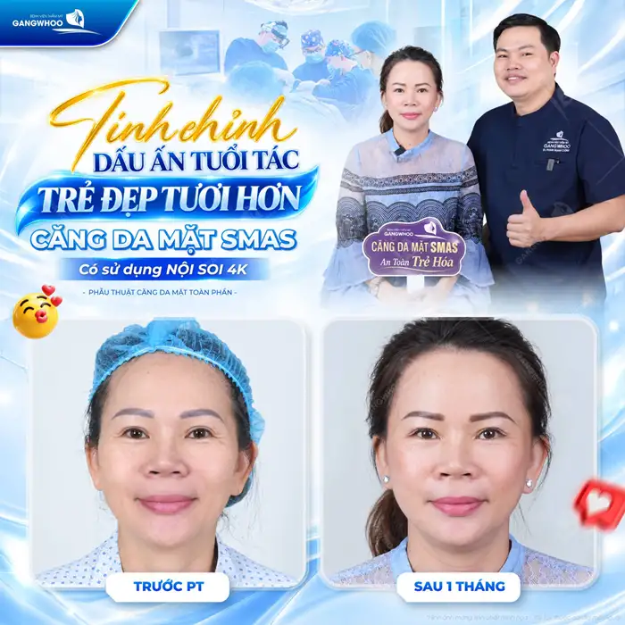 Căng Da Mặt Có Hại Không? Điều Cần Lưu Ý Để Căng Da Mặt An Toàn