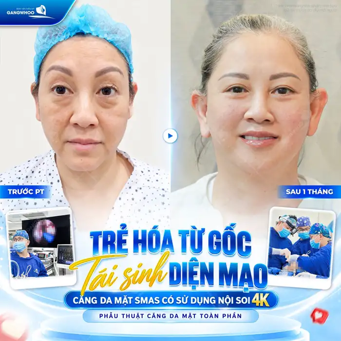 Cách Làm Căng Da Mặt Chảy Xệ Hiệu Quả Hiện Nay