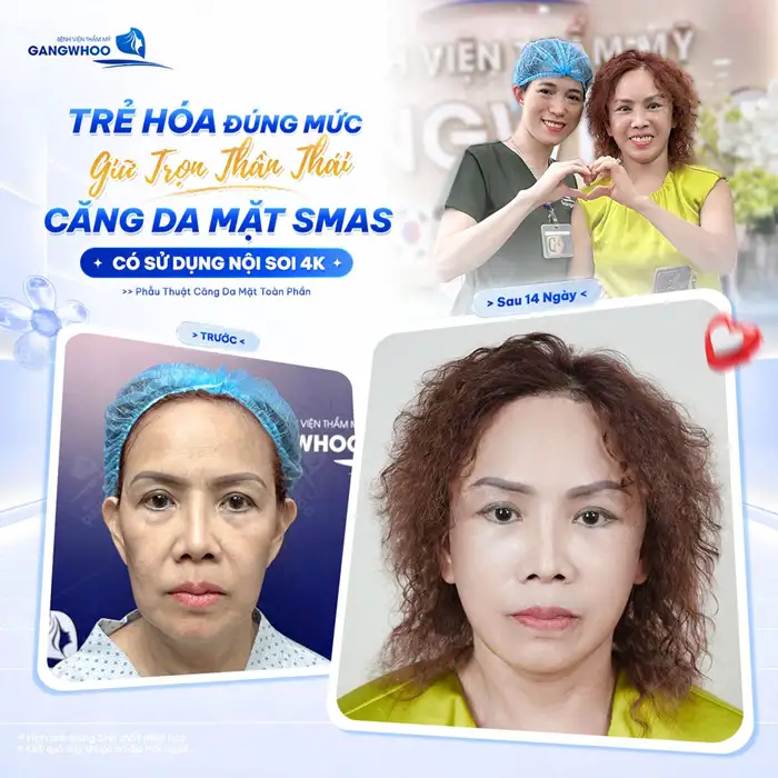 Căng Da Mặt Bao Lâu Thì Lành? Cách Chăm Sóc Da Mặt Hồi Phục Nhanh Hơn