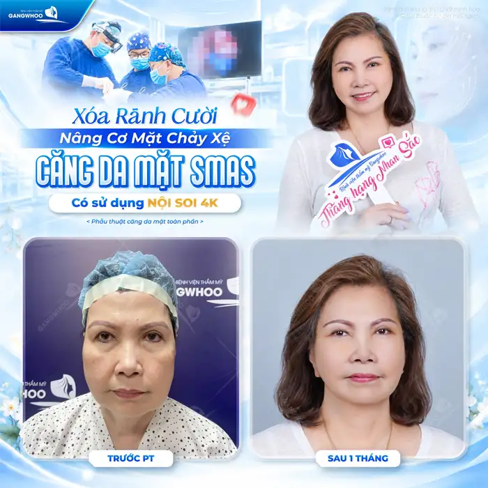 Căng Da Mặt Bao Lâu Thì Lành? Cách Chăm Sóc Da Mặt Hồi Phục Nhanh Hơn