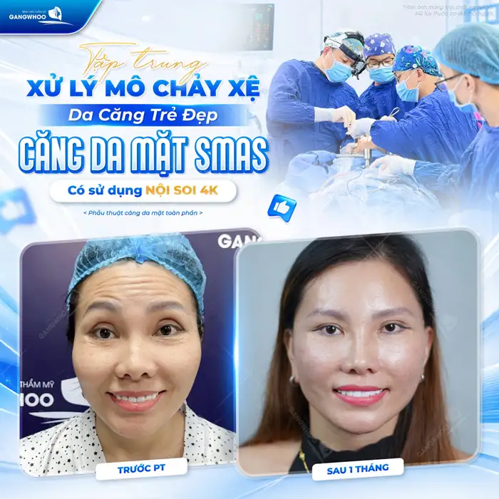 Những Phương Pháp Căng Da Mặt Nào Hiệu Quả – Hiện Nay?