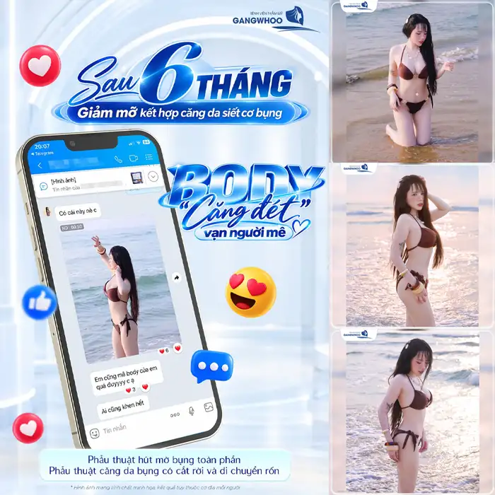 Hút Mỡ “Lột Xác” Hóa Eo Thon Gọn An Toàn, Nhanh Chóng