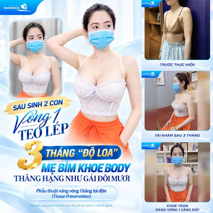 Thoát Kiếp “Lép” Nhanh Chóng Và An Toàn Nhờ Thẩm Mỹ Nâng Ngực