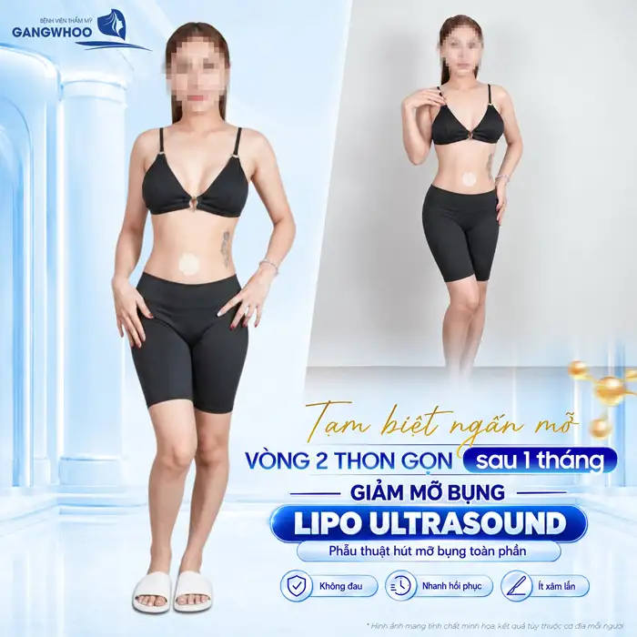 Hút Mỡ “Lột Xác” Hóa Eo Thon Gọn An Toàn, Nhanh Chóng