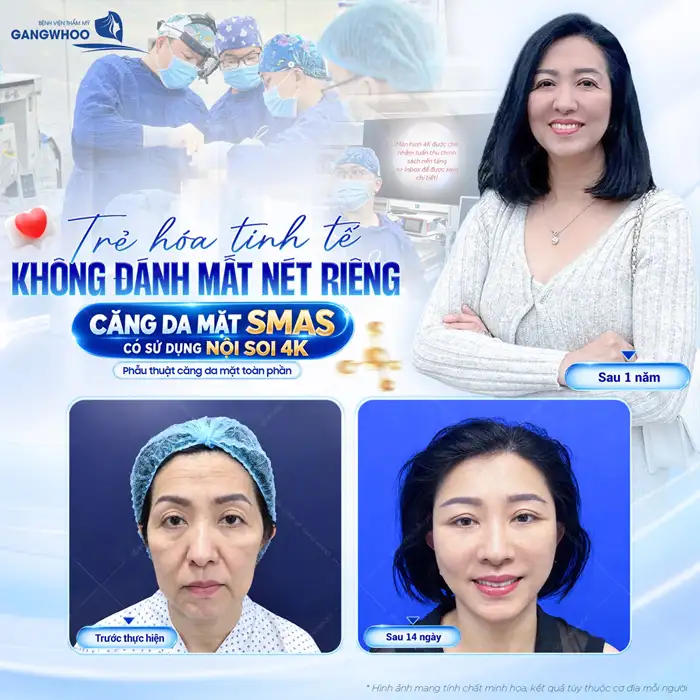 Căng Da Mặt Phẫu Thuật – Giải Pháp Cho Làn Da Nói Không Với Lão Hóa