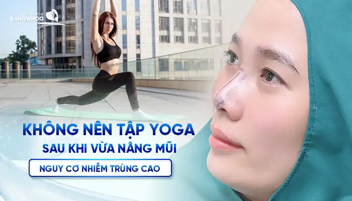 Nâng Mũi Bao Lâu Được Tập Yoga? Hướng Dẫn Tập Đúng Sau Nâng