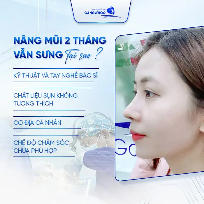 Nâng Mũi 2 Tháng Vẫn Sưng Có Sao Không? Khắc Phục Thế Nào