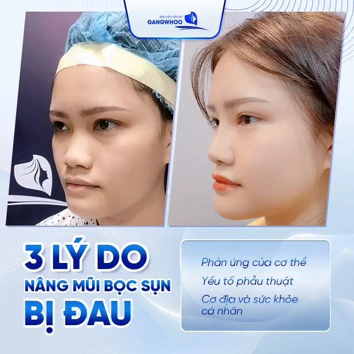 Nâng Mũi Bọc Sụn Có Đau Không? Lời Khuyên Của Bác Sĩ