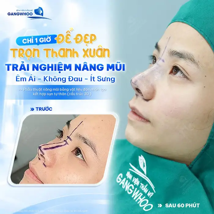 Nâng Mũi Bọc Sụn Có Đau Không? Lời Khuyên Của Bác Sĩ