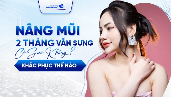 Nâng Mũi 2 Tháng Vẫn Sưng Có Sao Không? Khắc Phục Thế Nào