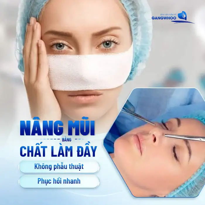 Có Nên Nâng Mũi Bằng Chất Làm Đầy Không? 