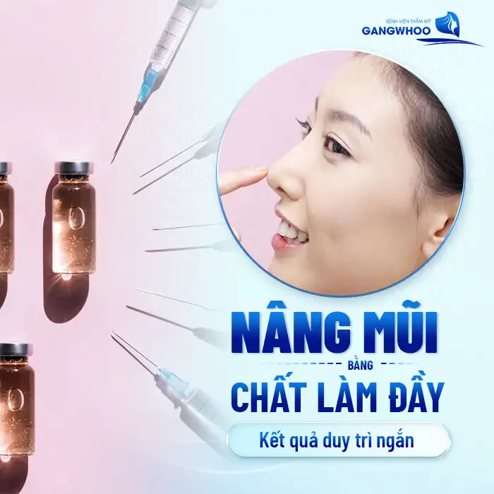 Có Nên Nâng Mũi Bằng Chất Làm Đầy Không? 