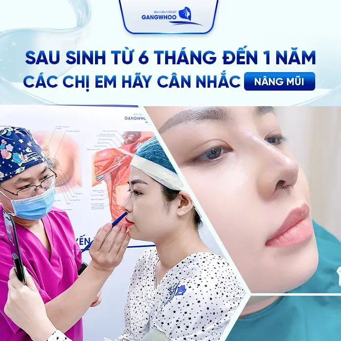 Có Bầu Đi Nâng Mũi Được Không? Bao Lâu Mới Được Nâng Mũi