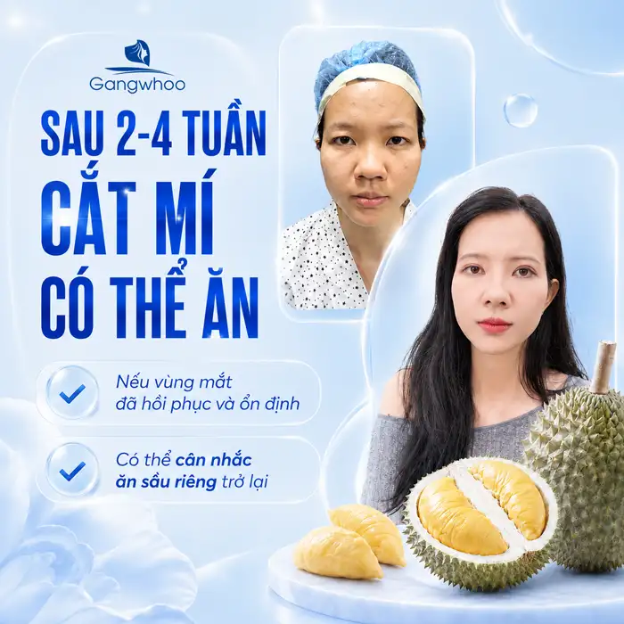 Cắt Mí Mắt Ăn Sầu Riêng Được Không? Những Điều Bác Sĩ Khuyên Bạn