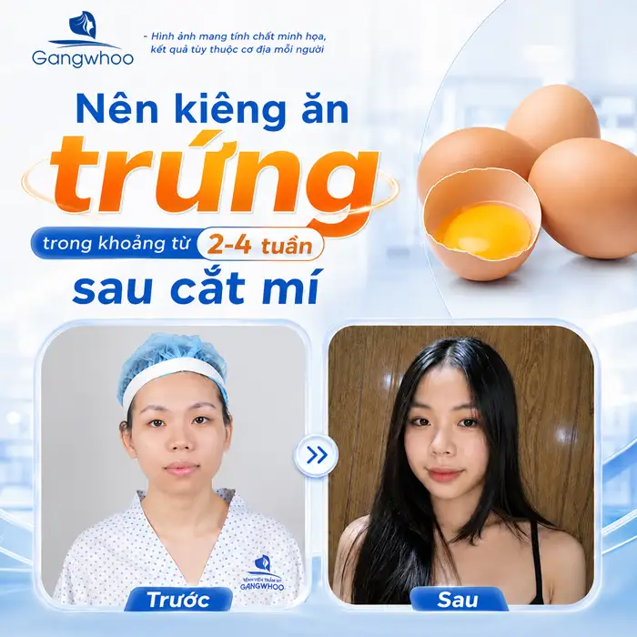 Cắt Mí Mắt Ăn Sầu Riêng Được Không? Những Điều Bác Sĩ Khuyên Bạn