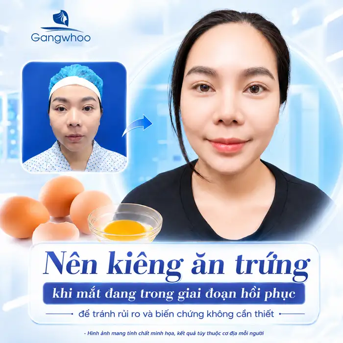 Cắt Mí Mắt Ăn Sầu Riêng Được Không? Những Điều Bác Sĩ Khuyên Bạn