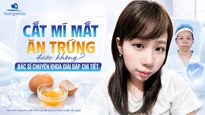 Cắt Mí Mắt Ăn Sầu Riêng Được Không? Những Điều Bác Sĩ Khuyên Bạn