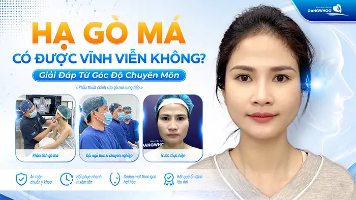 Hạ Gò Má Có Được Vĩnh Viễn Không? Bác Sĩ Chuyên Khoa Chia Sẻ