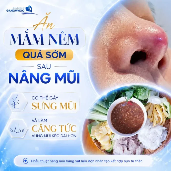 Nâng Mũi Ăn Mắm Nêm Được Không? Bác Sĩ Giải Đáp Góc Độ Chuyên Môn