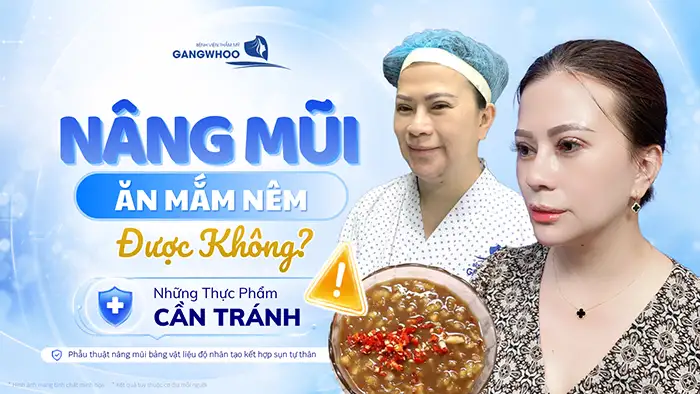Nâng Mũi Ăn Mắm Nêm Được Không? Bác Sĩ Giải Đáp Góc Độ Chuyên Môn