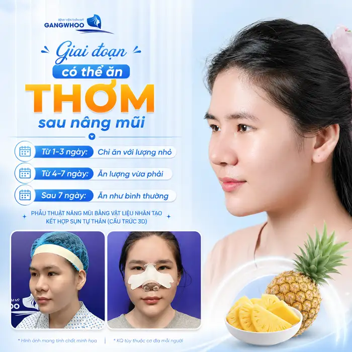 Nâng Mũi Ăn Thơm Được Không? Bác Sĩ Giải Đáp Thời Điểm Ăn An Toàn