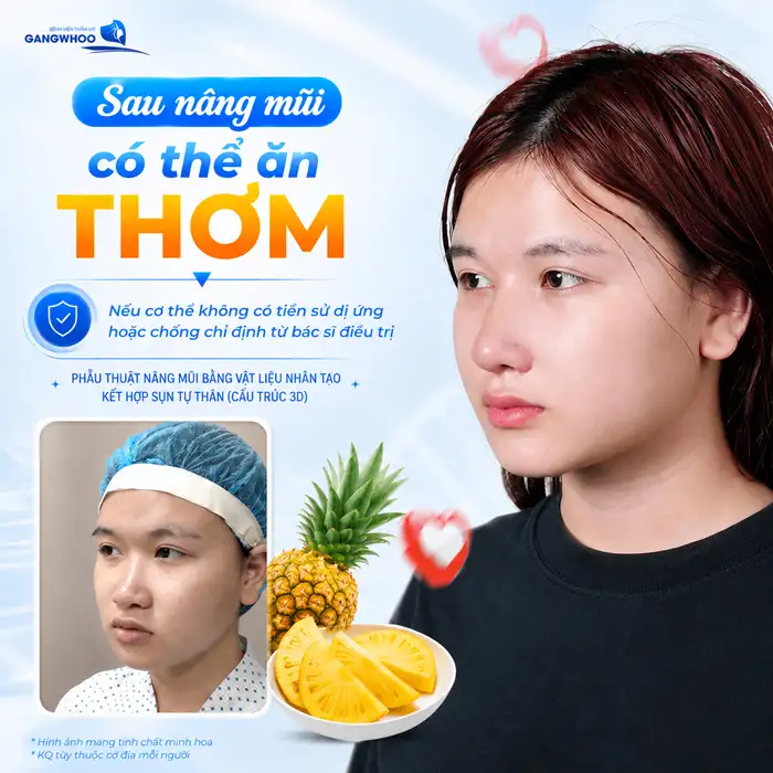 Nâng Mũi Ăn Thơm Được Không? Bác Sĩ Giải Đáp Thời Điểm Ăn An Toàn
