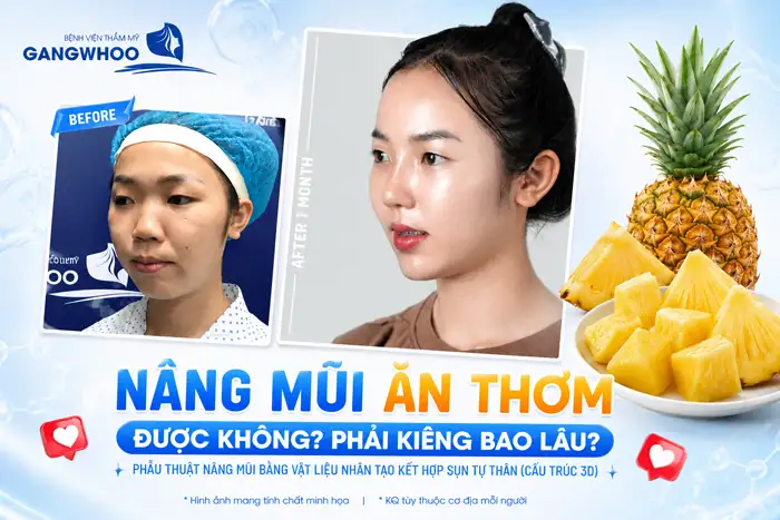 Nâng Mũi Ăn Thơm Được Không? Bác Sĩ Giải Đáp Thời Điểm Ăn An Toàn