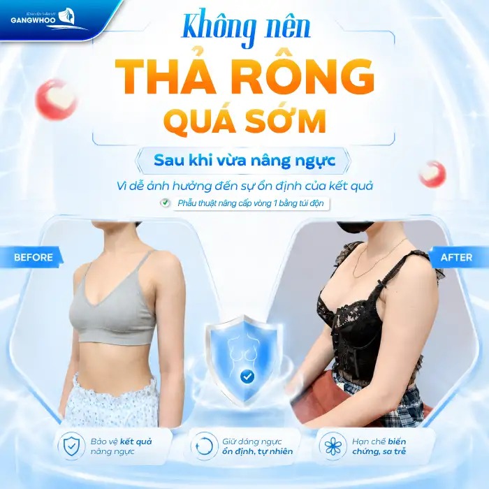 Nâng Ngực Bao Lâu Được Thả Rông? Bác Sĩ Giải Đáp Thời Điểm An Toàn
