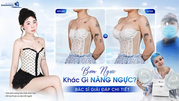 Bơm Ngực Khác Gì Nâng Ngực? Nên Lựa Chọn Phương Pháp Nào?