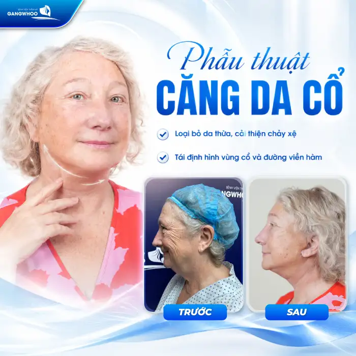 Căng Da Cổ Giá Bao Nhiêu? Bảng Giá Mới Nhất & Yếu Tố Ảnh Hưởng