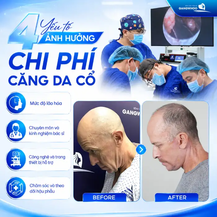 Căng Da Cổ Giá Bao Nhiêu? Bảng Giá Mới Nhất & Yếu Tố Ảnh Hưởng