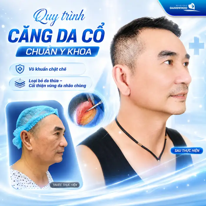 Căng Da Cổ Giá Bao Nhiêu? Bảng Giá Mới Nhất & Yếu Tố Ảnh Hưởng