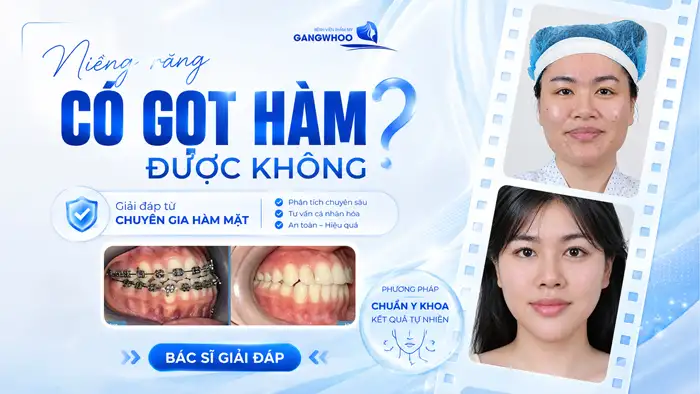 Đang Niềng Răng Có Gọt Hàm Được Không? Những Điều Cần Lưu ý