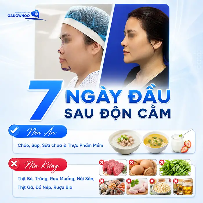 Độn Cằm Bao Lâu Cười Được? Lời Khuyên Từ Bác Sĩ Để Hồi Phục Nhanh Và An Toàn