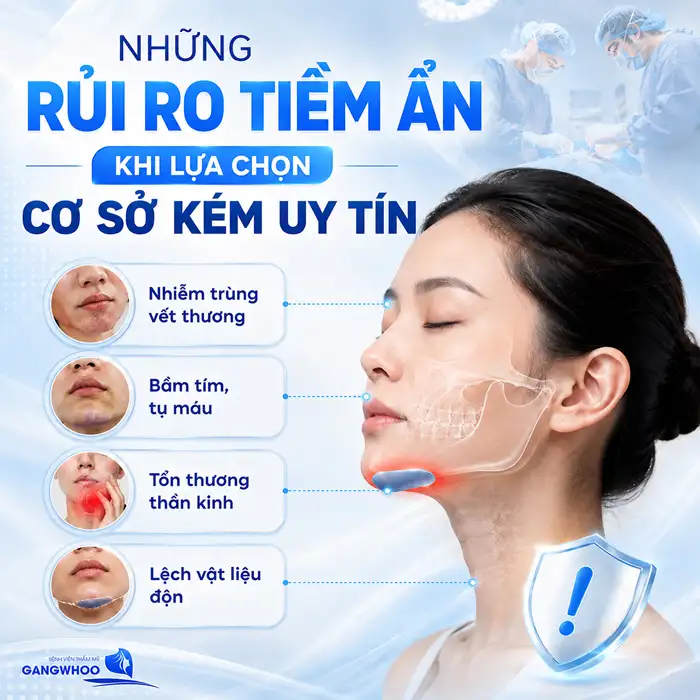 Độn Cằm Bao Lâu Cười Được? Lời Khuyên Từ Bác Sĩ Để Hồi Phục Nhanh Và An Toàn