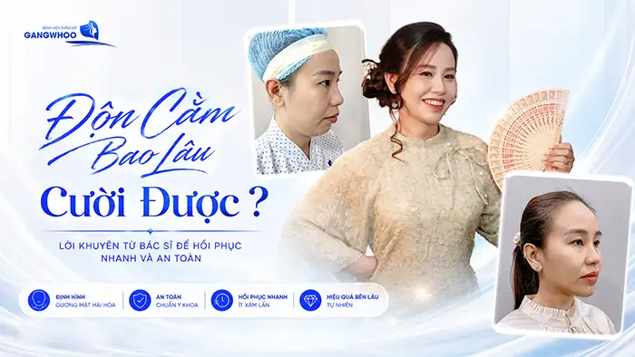 Độn Cằm Bao Lâu Cười Được? Lời Khuyên Từ Bác Sĩ Để Hồi Phục Nhanh Và An Toàn