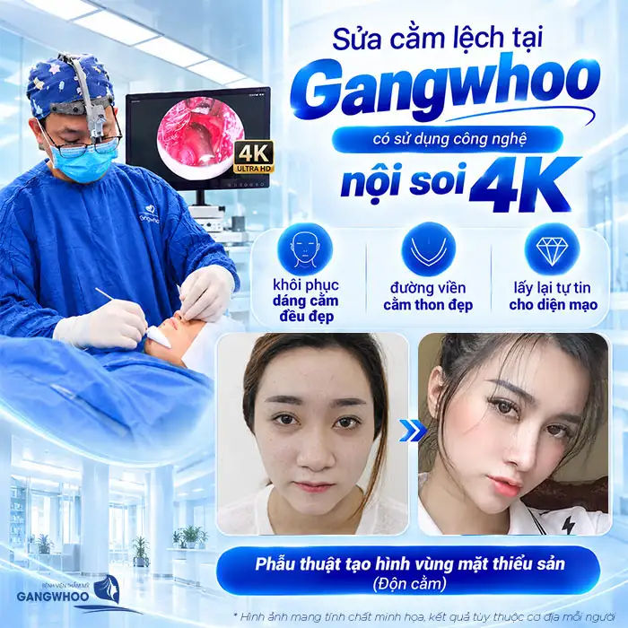 Độn Cằm Bị Lệch Phải Làm Sao? Nguyên Nhân Và Cách Khắc Phục