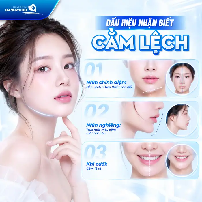 Độn Cằm Bị Lệch Phải Làm Sao? Nguyên Nhân Và Cách Khắc Phục