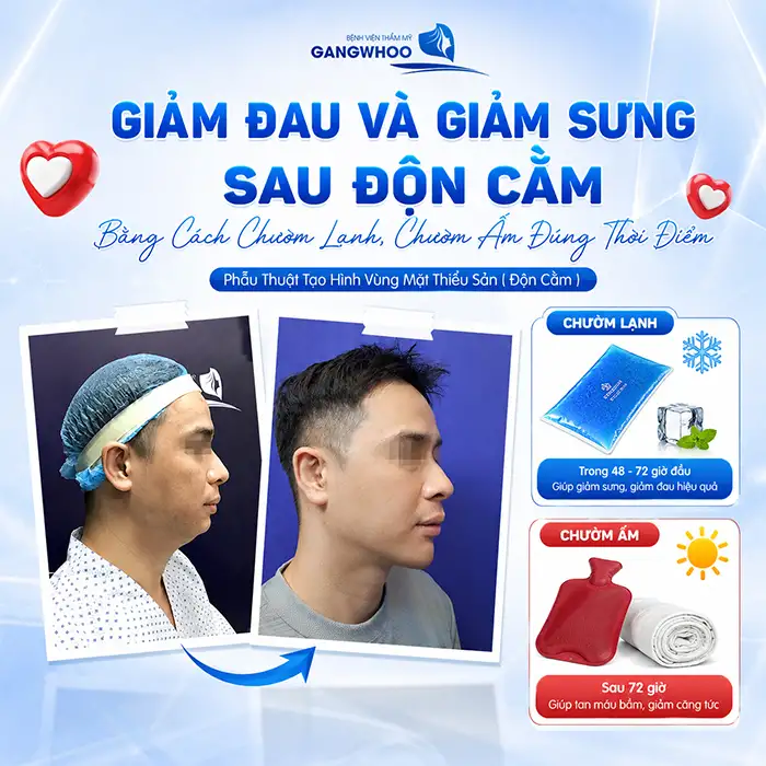 Độn Cằm Có Đau Không? Giải Đáp Chi Tiết Từ A-Z