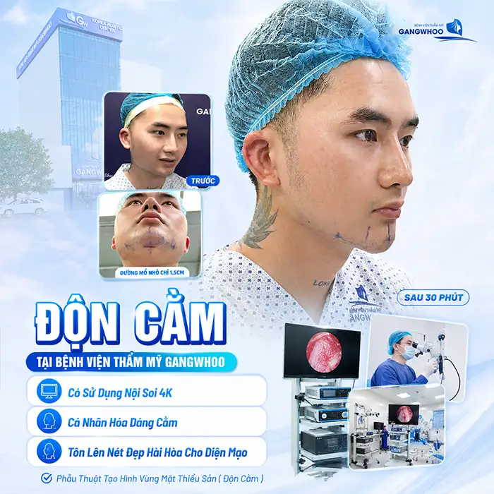 Độn Cằm Có Đau Không? Giải Đáp Chi Tiết Từ A-Z