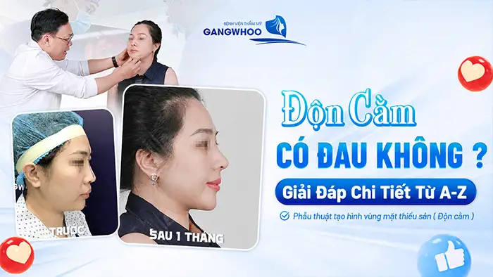 Độn Cằm Có Đau Không? Giải Đáp Chi Tiết Từ A-Z