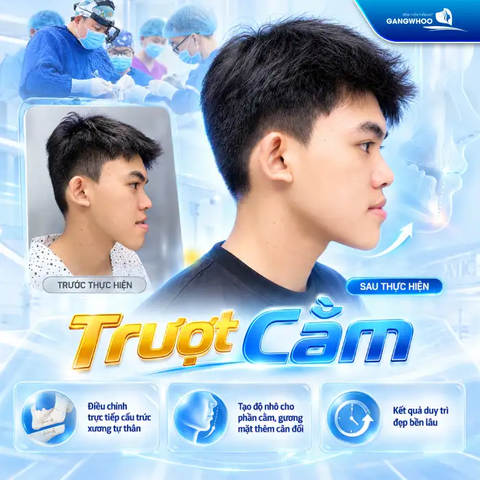 Độn Cằm Có Được Vĩnh Viễn Không? Giải Đáp Chi Tiết Từ Chuyên Gia