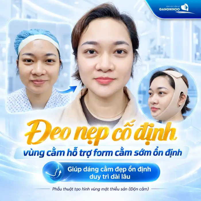 Độn Cằm Có Được Vĩnh Viễn Không? Giải Đáp Chi Tiết Từ Chuyên Gia